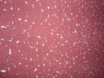 Textura liza.